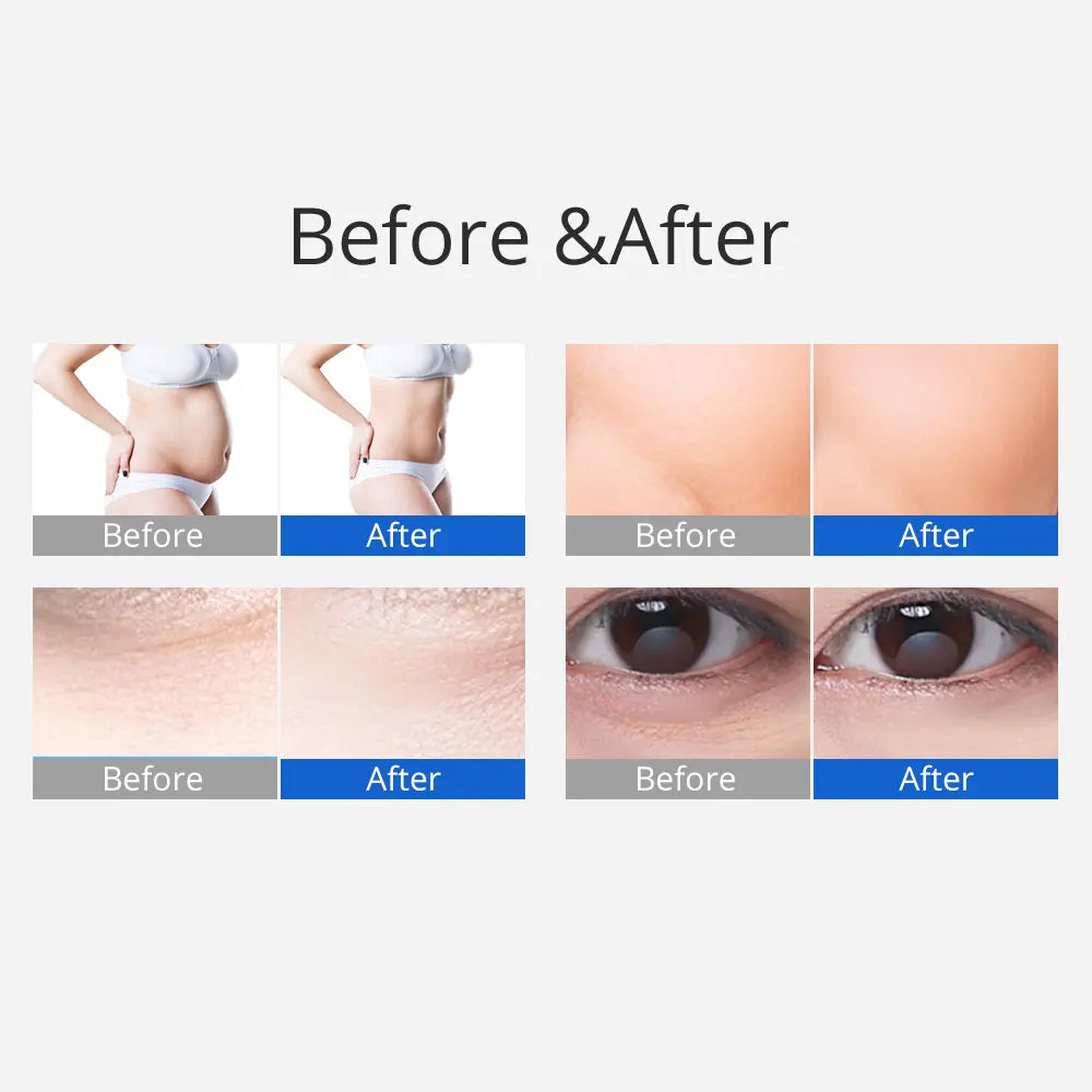 US STOCK 3 In 1 Ultrasound 40K Cavitation Radio Frequency Machine 3D RF Body Slimming Machine Cellulite Remover
