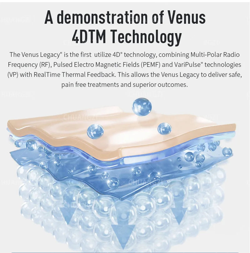 2025 New Venus legacy machine Skin Tightening Vacuum Slimming Cellulite Removal Skin Lifting Legacy Skin Lifting SPA Device