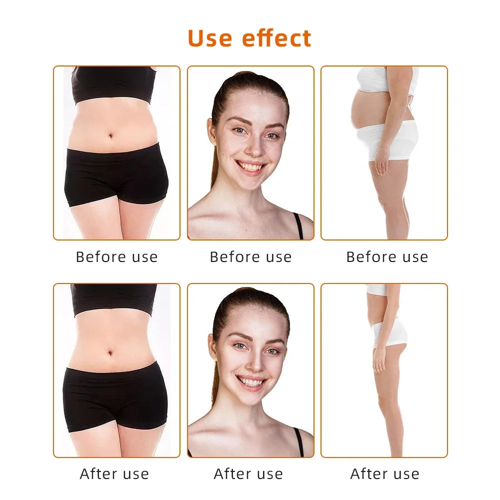 9 in 1 40K Cavitation Ultrasonic Body Slimming Machine Body Shape Loss Weight Vacuum Rejuvenation Skin Lift Tighten Tool