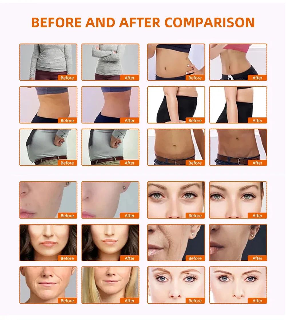 9 in 1 40K Cavitation Ultrasonic Body Slimming Machine Body Shape Loss Weight Vacuum Rejuvenation Skin Lift Tighten Tool
