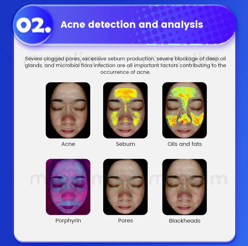 3D AI Facial Camera Scanner UV Skin and Hair Analysis Measuring Machine Digital Facial Scanner Skin Analyzer 2025 Professional